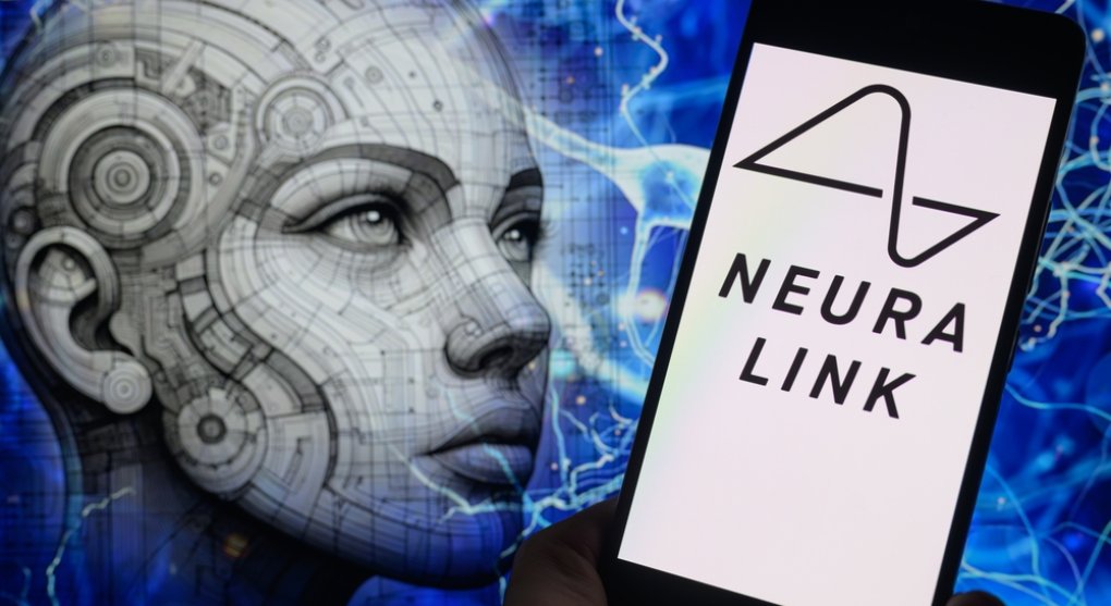 „Lepší než lidské oko.“ Muskův Neuralink vyvíjí nadějný implantát pro obnovu zraku